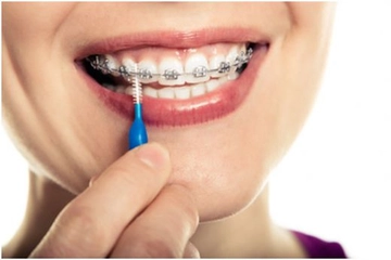 Diş Teli Fırçası Nasıl Olmalıdır?